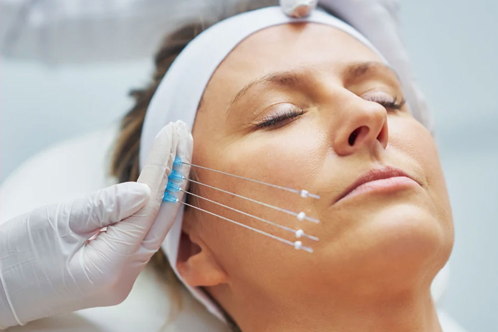 Treatment Threadlift di Glamritz Clinic